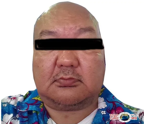 Залилагч А.Ганбат өвчнөөр ялаас мултрах зуураа дахин 80 сая төгрөгийн залилан хийлээ